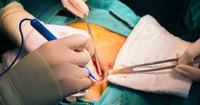 RK Pain Management Centre - Post Surgical Pain
